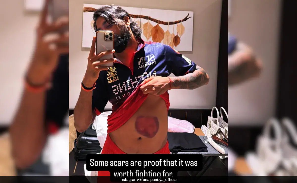 Krunal Pandya Shows His Battle Scars After Match-Winning 73 Against Mumbai Indians